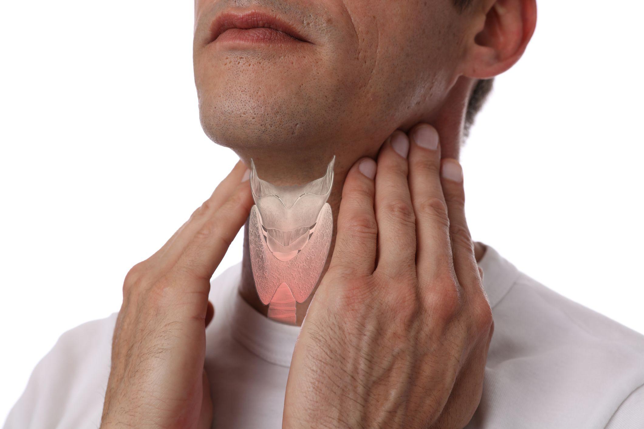 The Cervical Fusion Surgery Guide