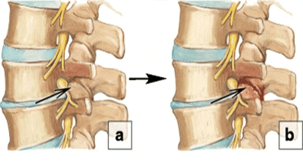 Diagram showing spinal segment.