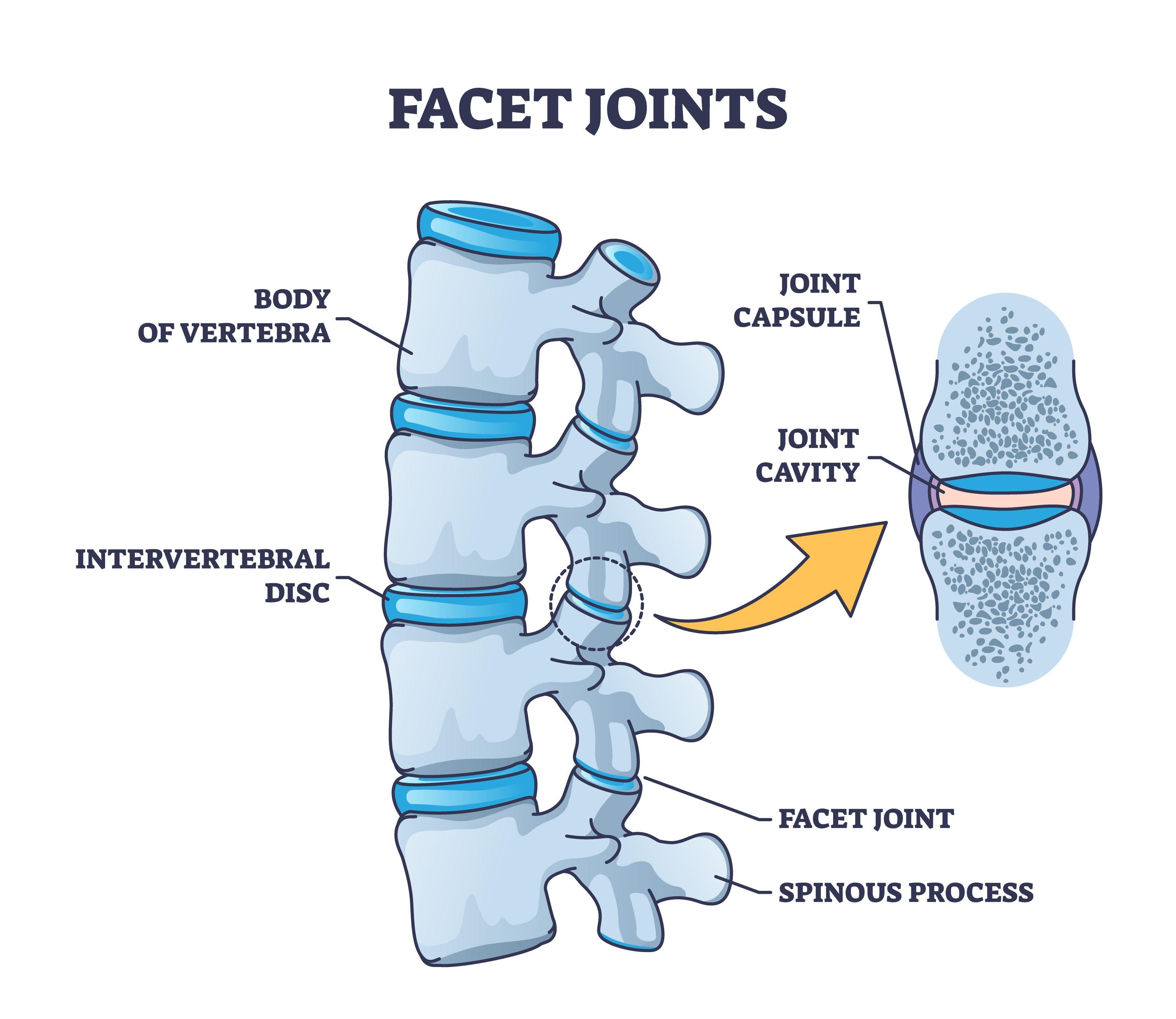 Illustration of spinal facet joints, vertebra, and intervertebral discs.