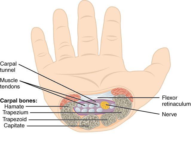 Diagram illustrating carpal tunnel anatomy in the human hand, highlighting bones, tendons, and nerves.