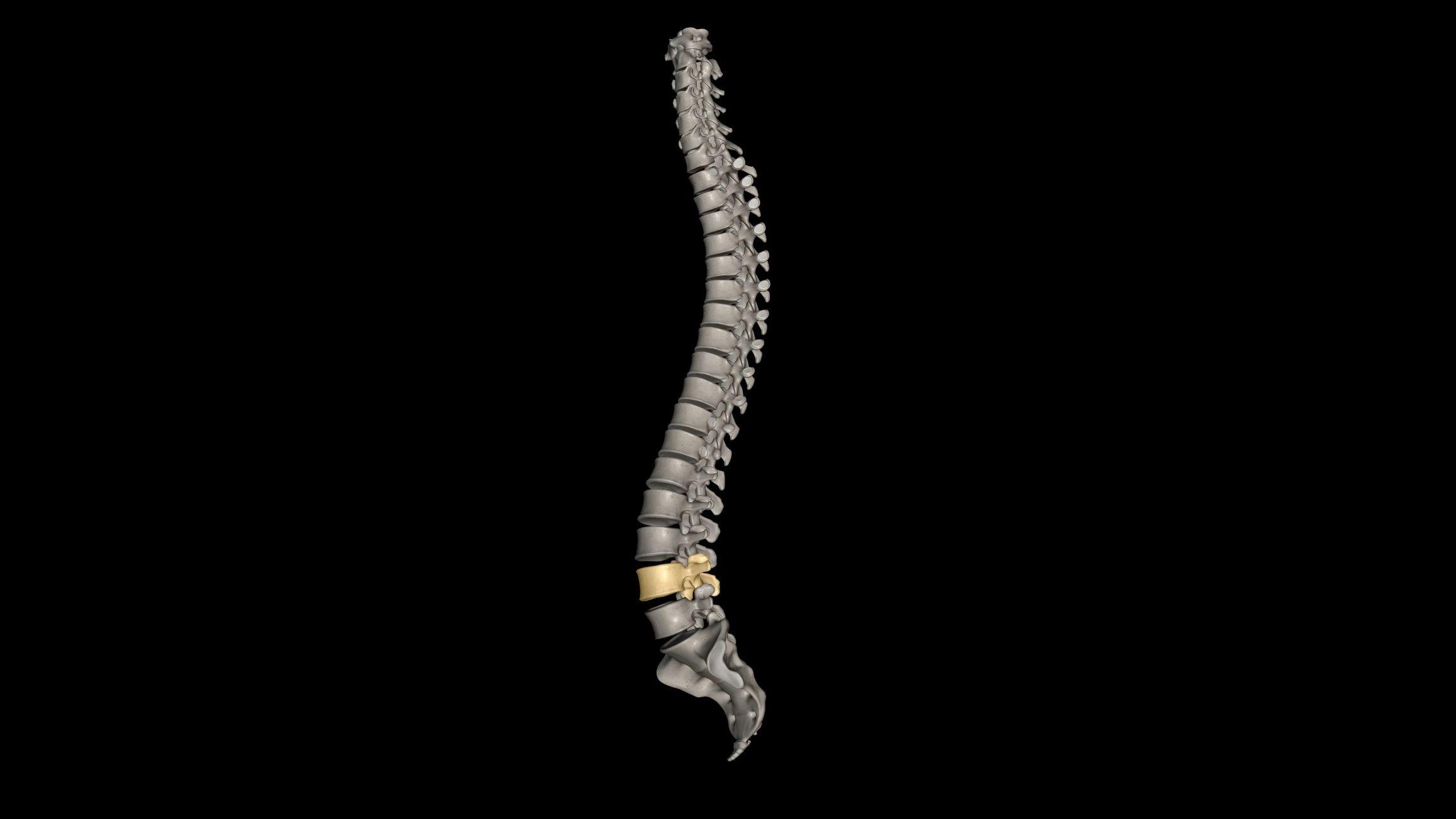 3D image of a human spine highlighting the L4-L5 disc herniation.