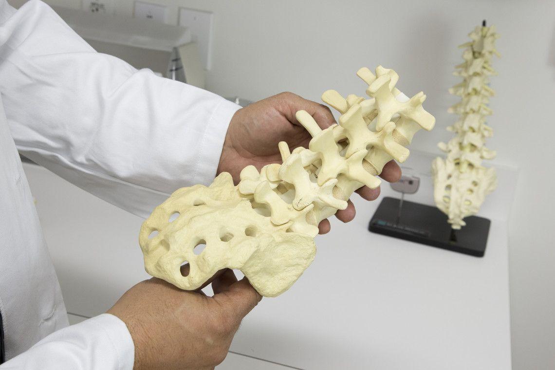 Illustrations of spinal stenosis in side and top views