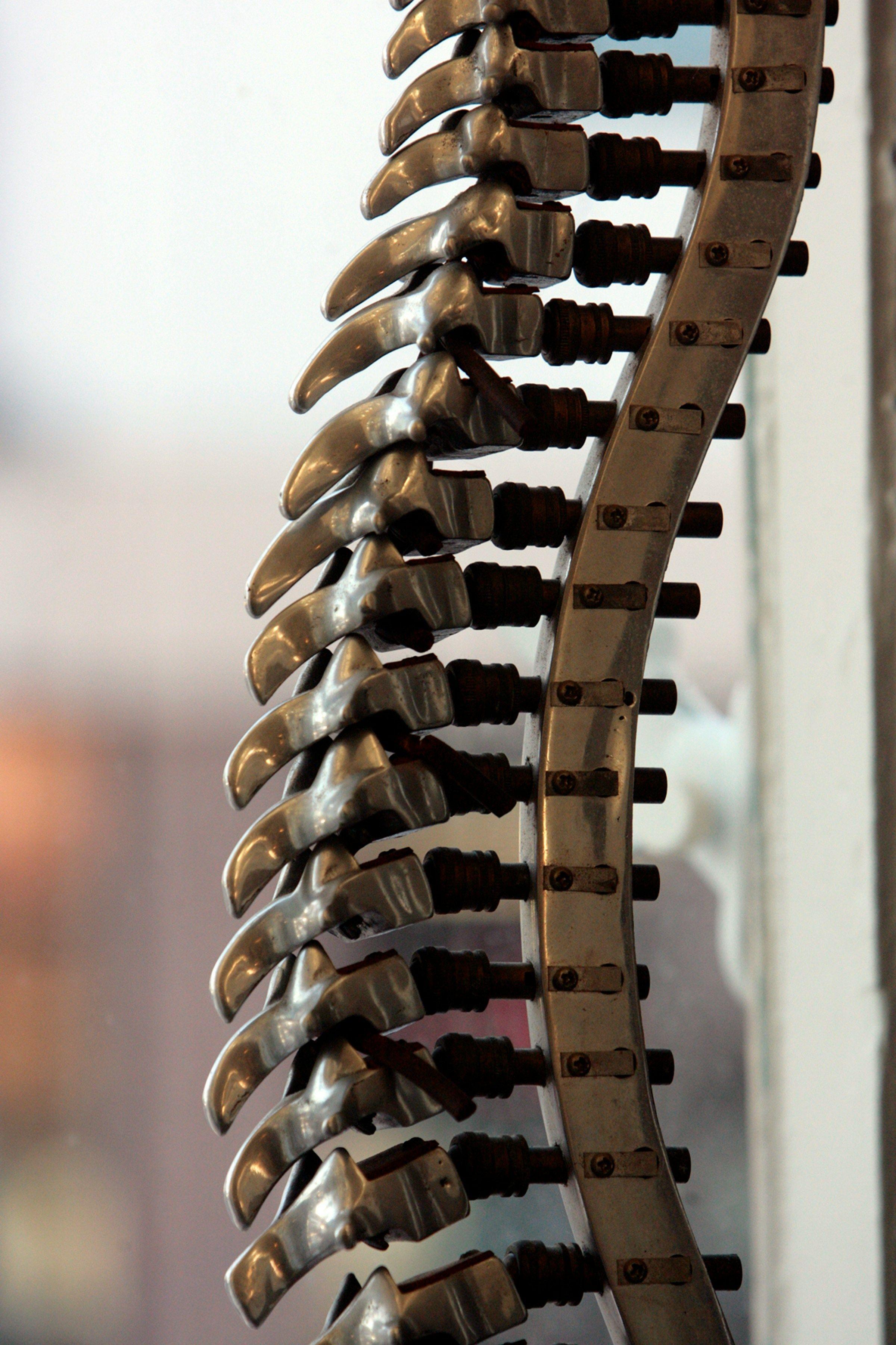 What are the Risks of Spinal Fusion Surgery?