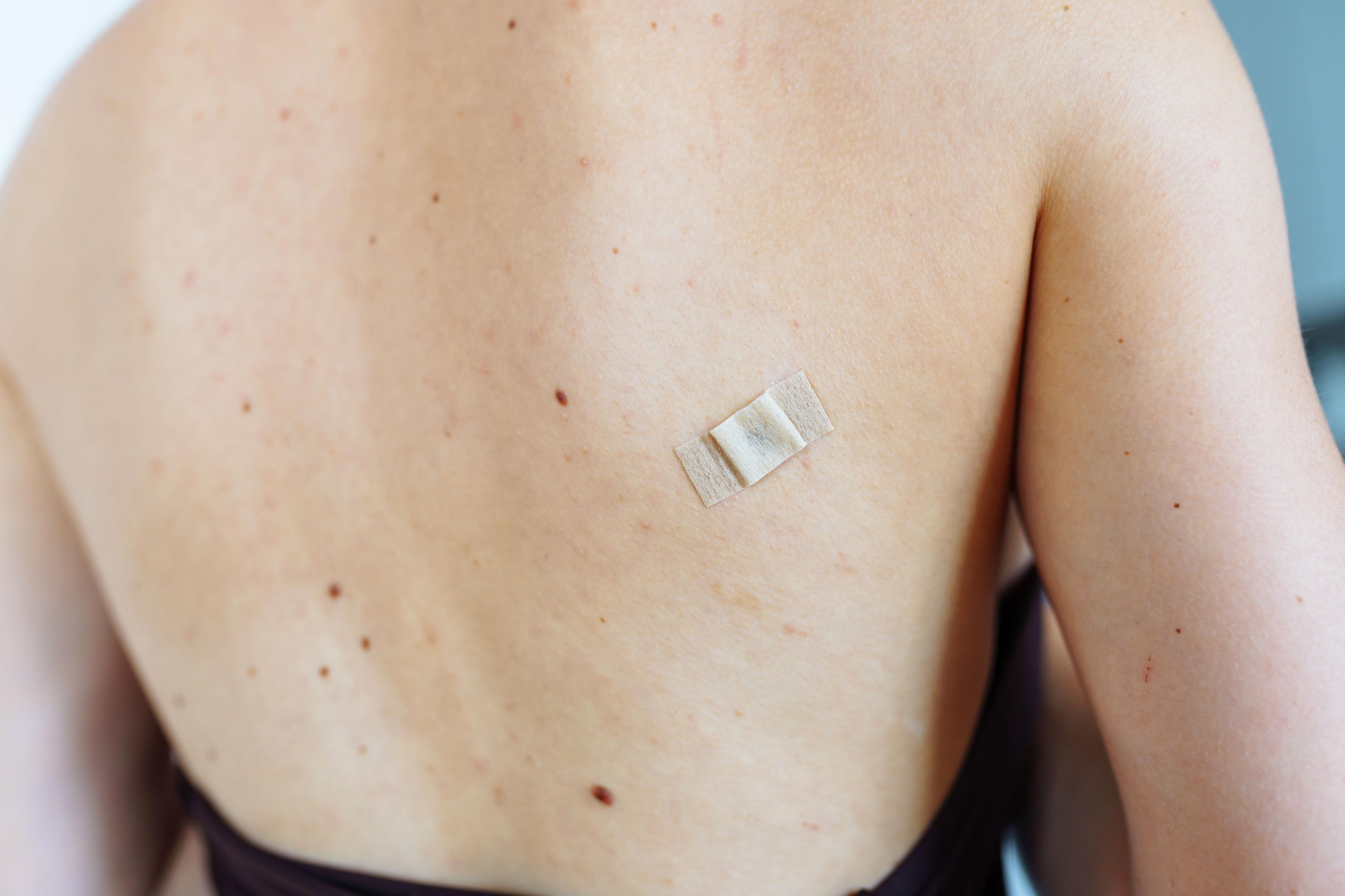 You Deserve Better Than Band-Aid Treatments for Back Pain