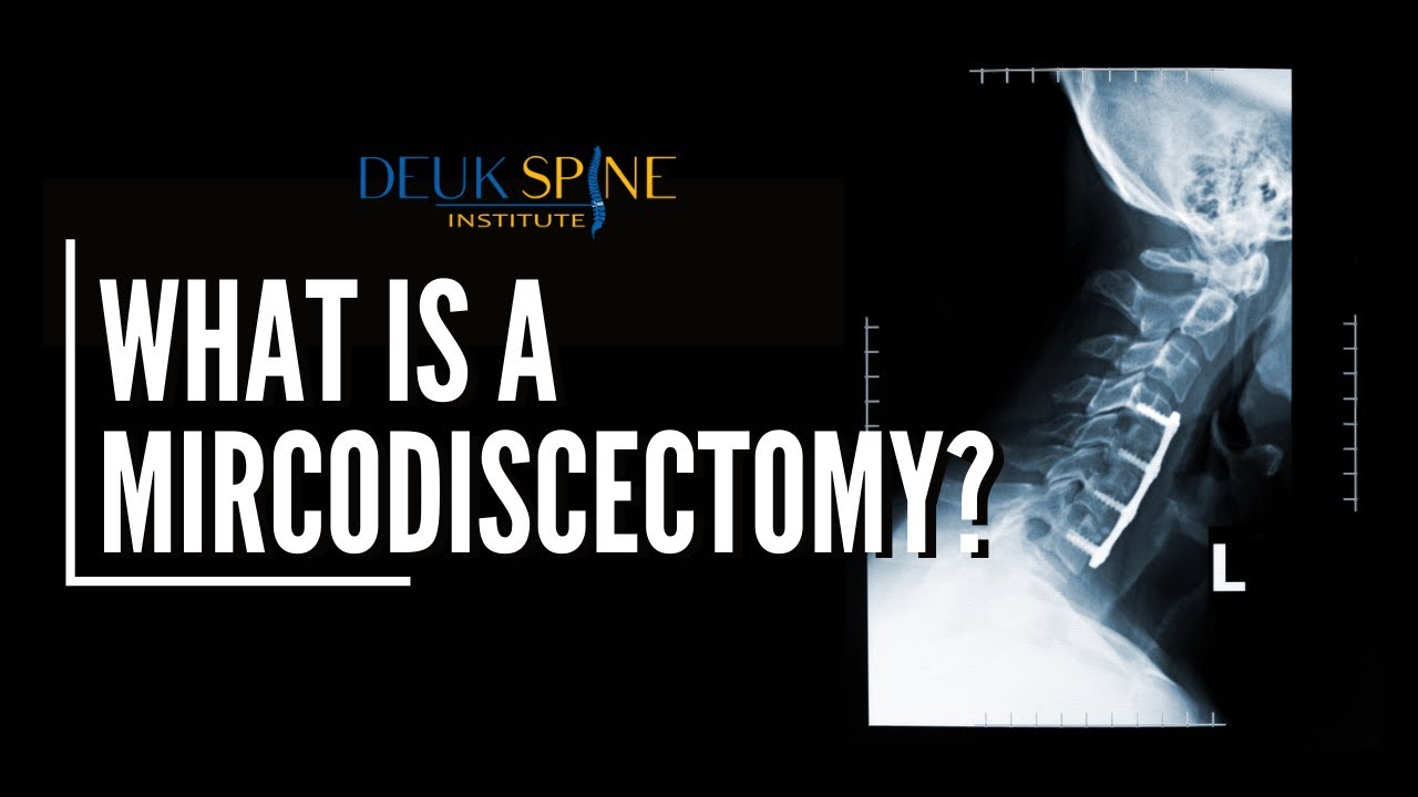 What is a Mircodiscectomy?