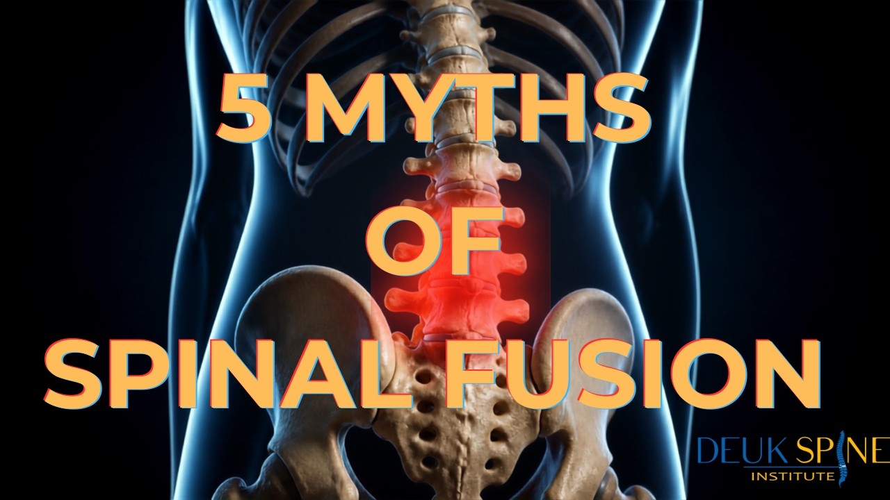5 MYTHS OF SPINAL FUSION | Deuk Spine Institute