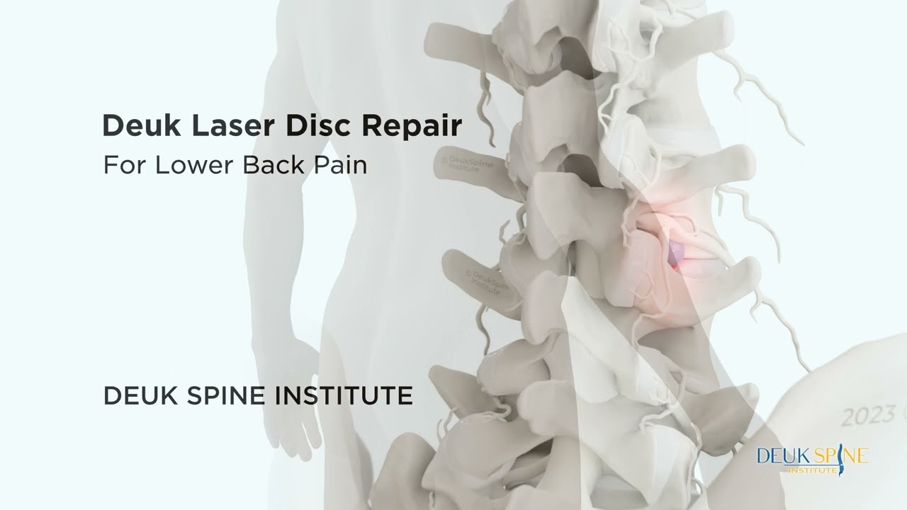 How the Deuk Laser Disc Repair CURES Lower Back Pain (with V.O. & Music)