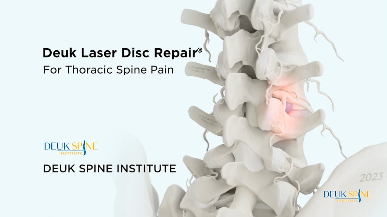 How to CURE Thoracic Back Pain with the Deuk Laser Disc Repair®
