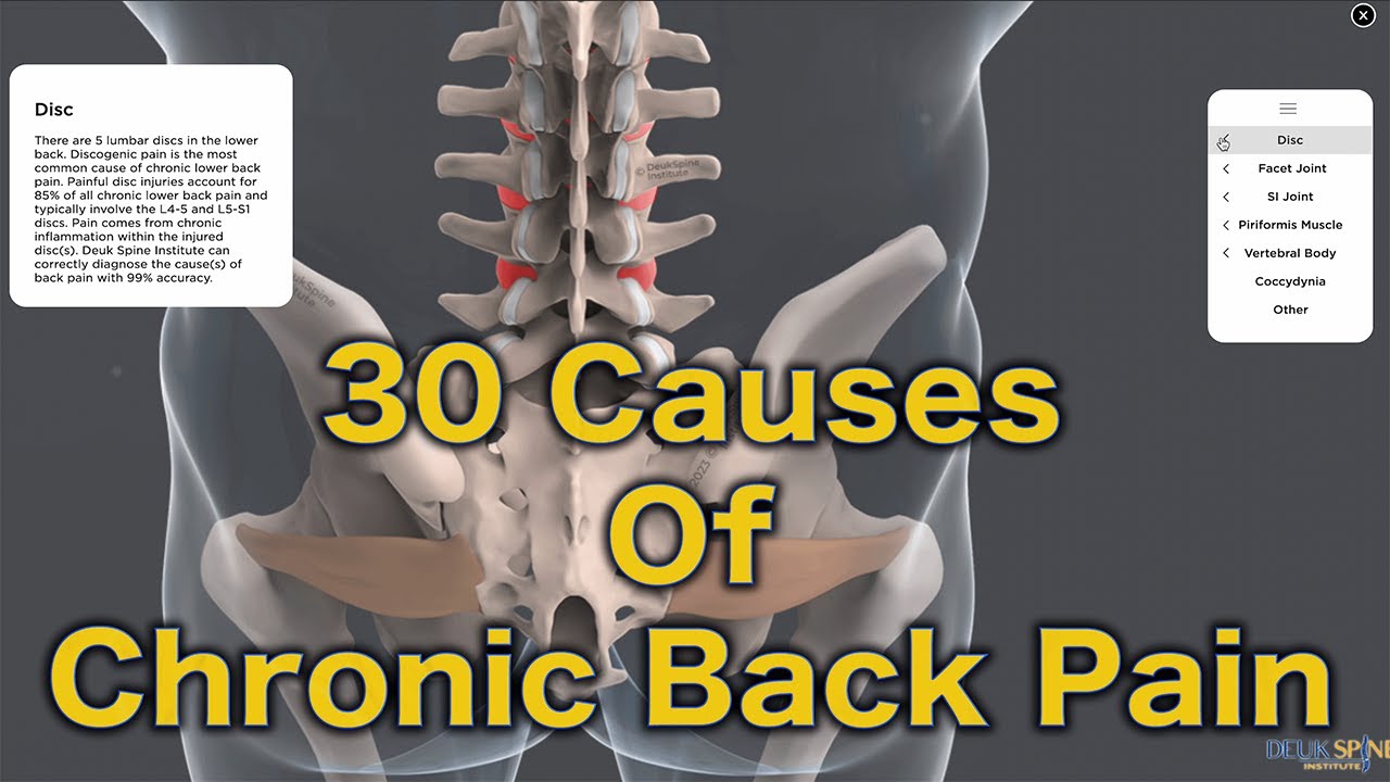 30 Causes of Back Pain | Deuk Spine Institute