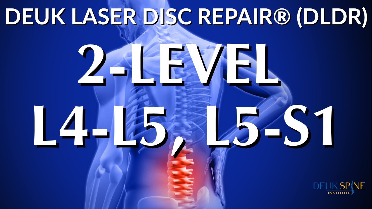 L4-L5 & L5-S1 LOWER BACK HERNIATIONS - LIVE - Laser Spine Surgery