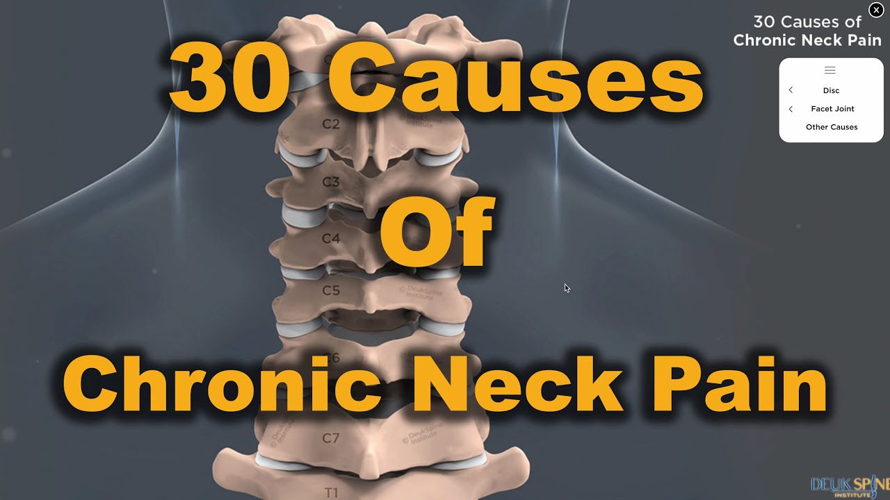 30 Causes of Neck Pain | Deuk Spine Institute