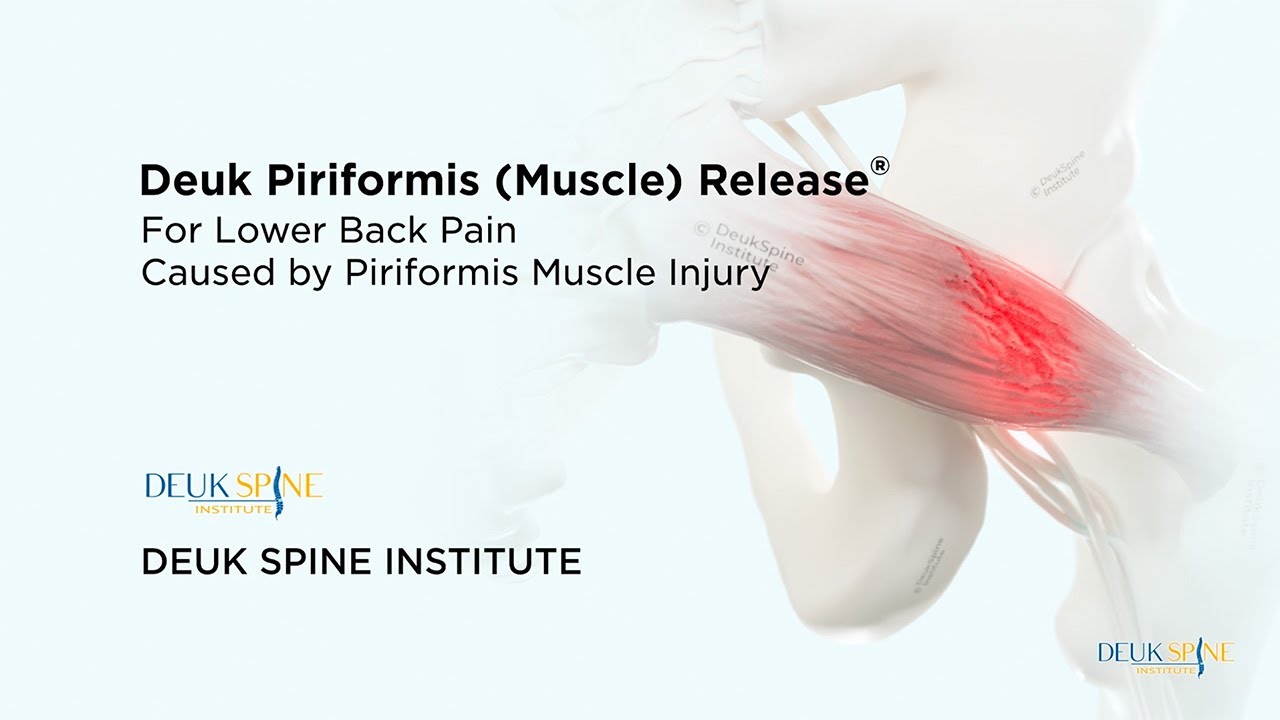 How to CURE Piriformis Muscle Syndrome with the Deuk Piriformis Release - (3D Animation)
