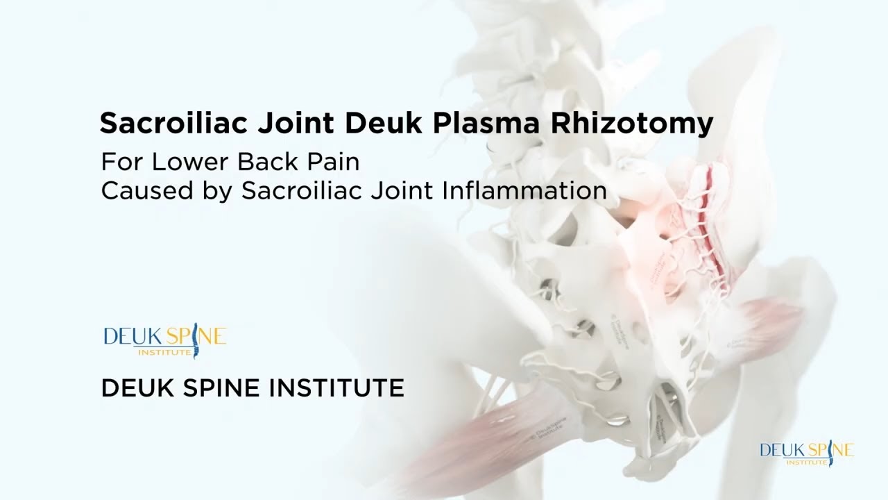 How to CURE Sacroiliac (SI) Joint Pain with the Deuk Plasma Rhizotomy (DPR) - (3D Animation)