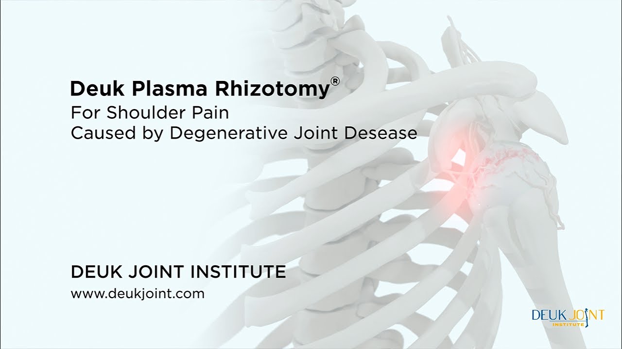 How to CURE Shoulder Pain with the Deuk Plasma Rhizotomy (DPR) - (3D Animation)
