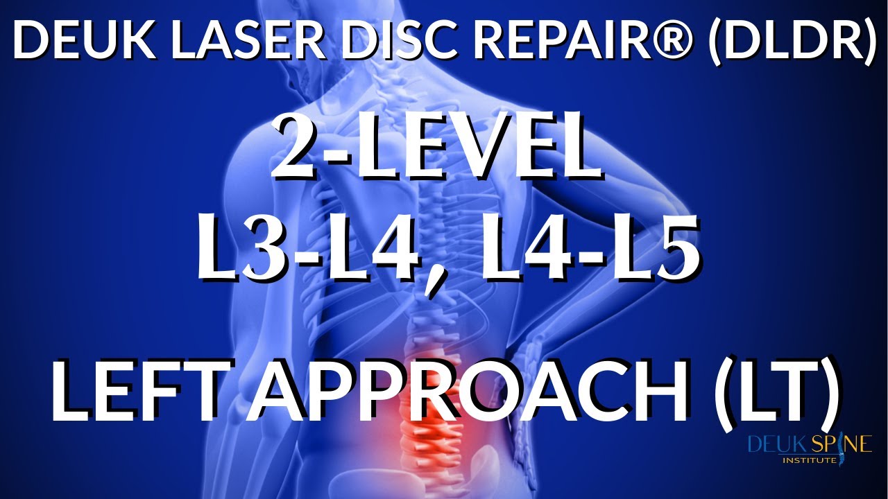 L3-L4, L4-L5 LOWER BACK PAIN - LIVE - Laser Spine Surgery