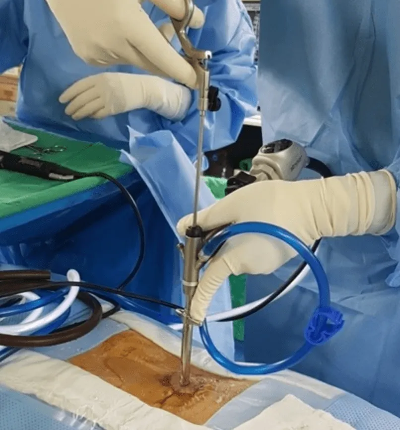 Minimally Invasive .png