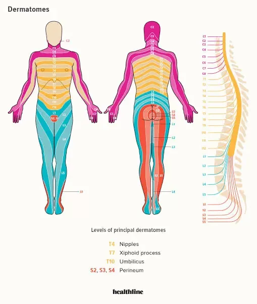 Illustration of dermatomes showing sensory nerve distribution across the human body by spinal levels.
