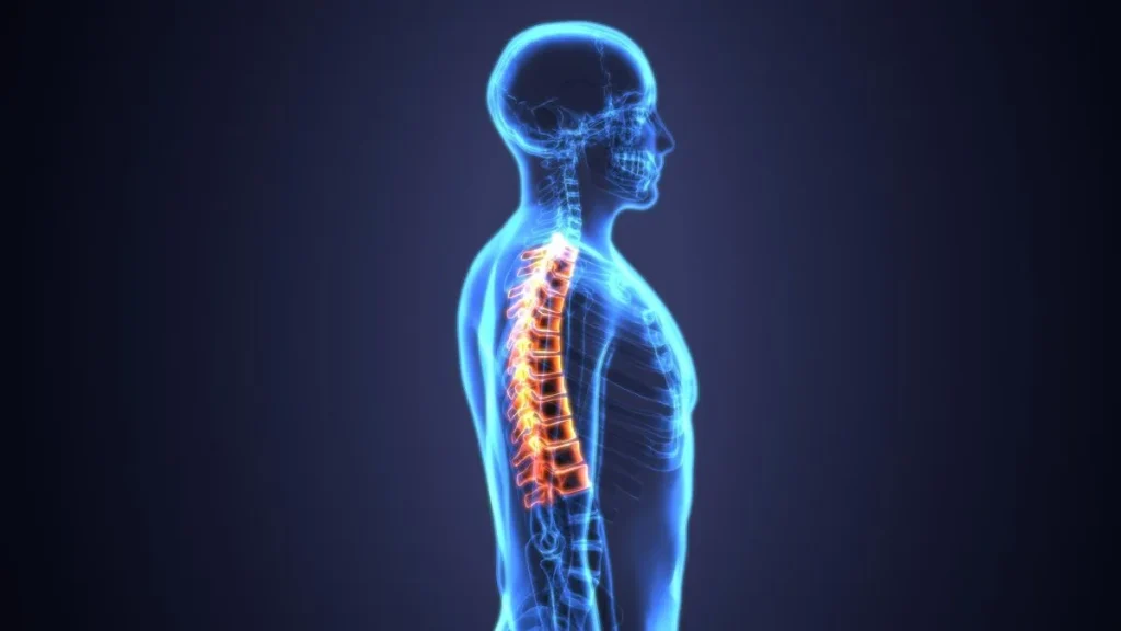 X-ray side view shows herniated disc highlighted in a glowing spine.