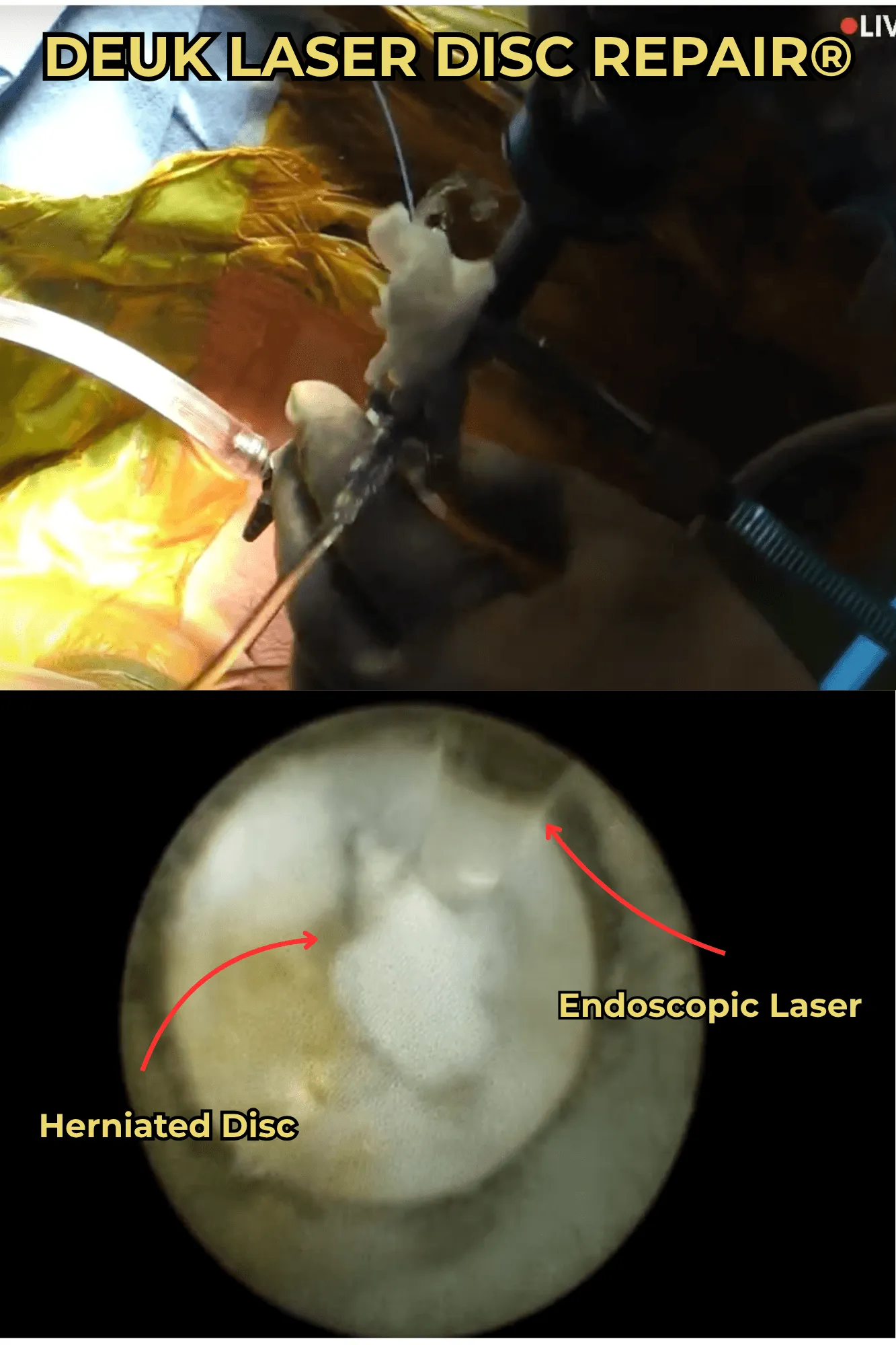 DEUK LASER DISC REPAIR® (1).png