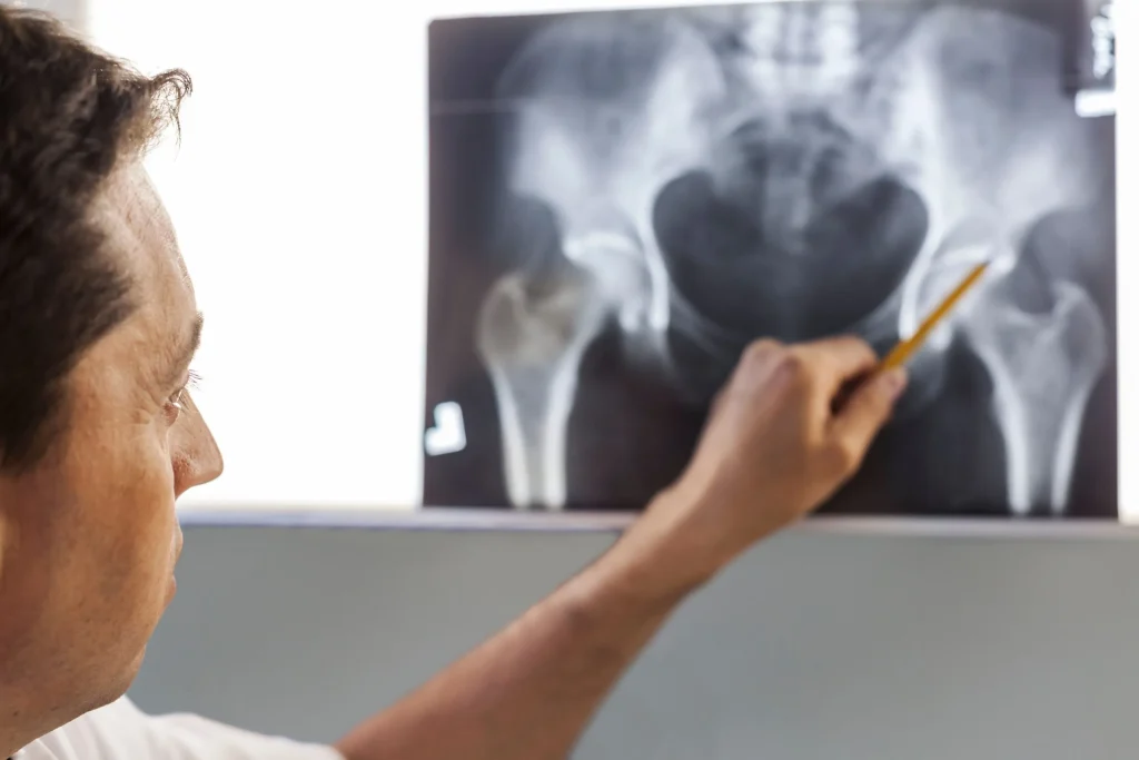 doctor-pointing-at-x-ray-of-a-pelvis-2024-09-19-02-21-27-utc.jpg