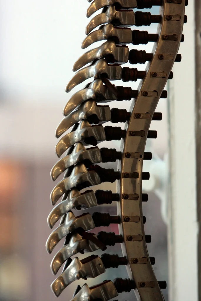 Close-up of a metal spinal model, illustrating spinal fusion surgery risks and complications.