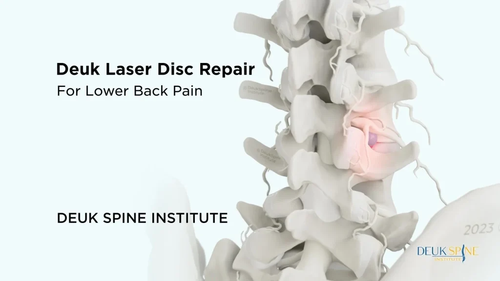 D spine model highlighting the "Deuk Laser Disc Repair" for lower back pain at Deuk Spine Institute.