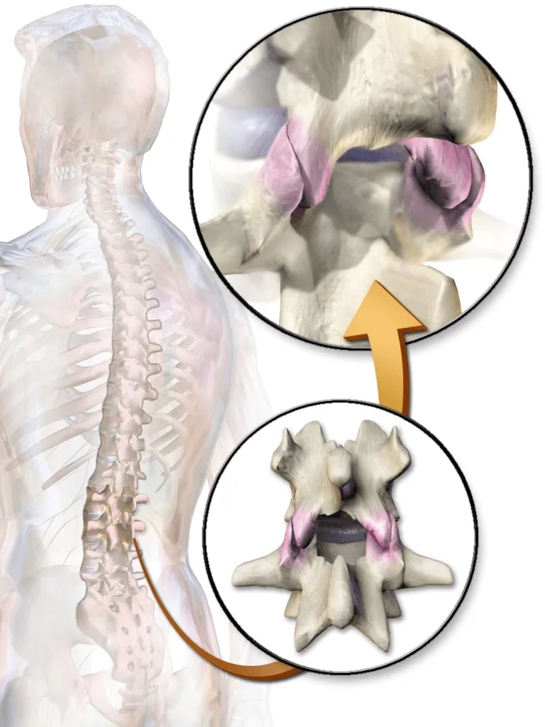 Image of facet joints in the spine