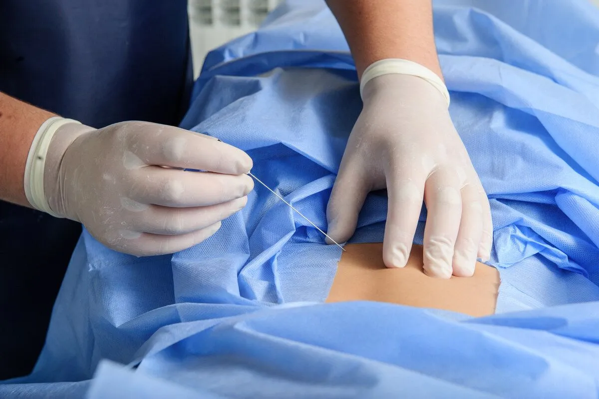 Physician using a needle on a person's back on the operating table.