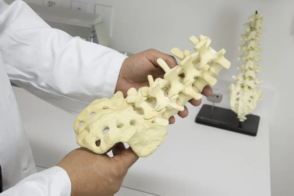 Illustrations of spinal stenosis in side and top views
