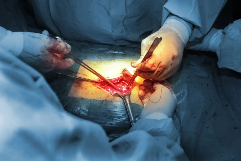 Surgeons operating on a patient, using surgical tools under bright lighting.