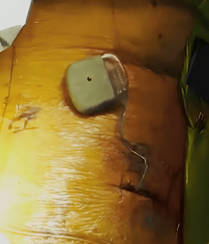 Close-up of a face with a bandage and a small sensor attached.