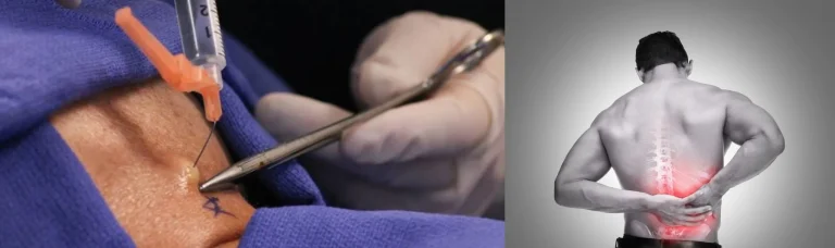 A close-up of a needle injection next to an image of a person holding their back in pain.