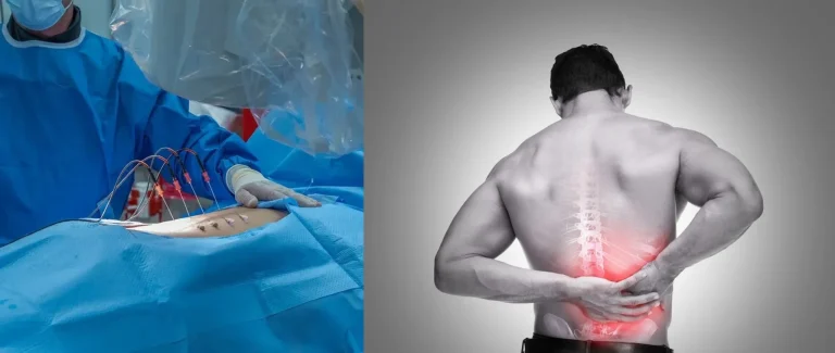 Left: surgical procedure on patient, Right: man holding lower back with highlighted spine pain.