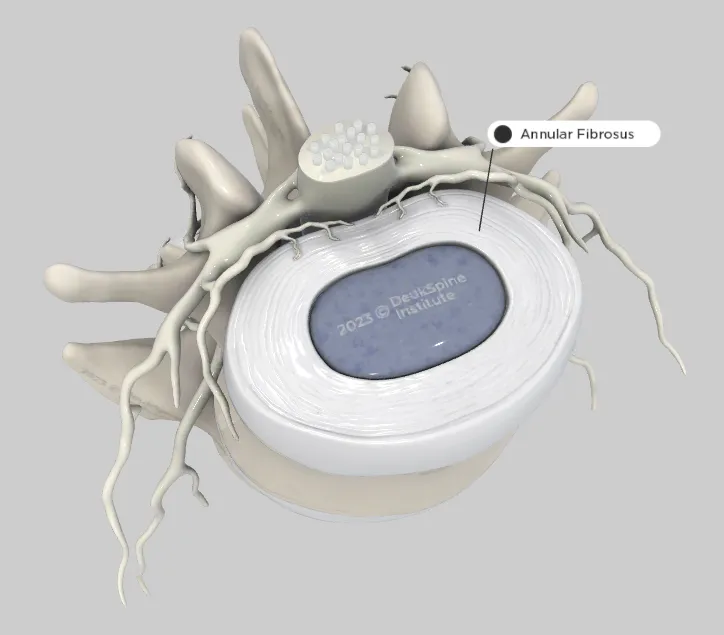 D rendering of a spinal disc with an annular fibrosus label.