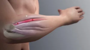 Illustration of a human forearm showing tendons and muscle structure beneath the skin.