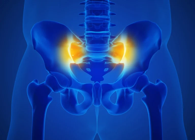 Benefits of SI Joint Deuk Plasma Rhizotomy