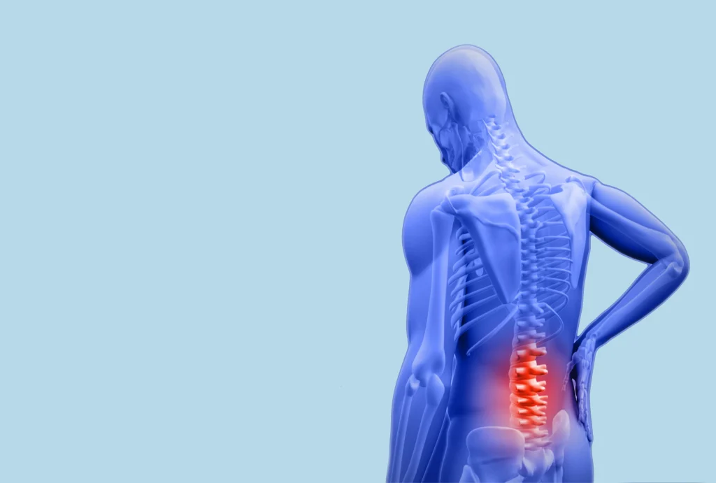 Illustration of a person with highlighted lower spine pain.