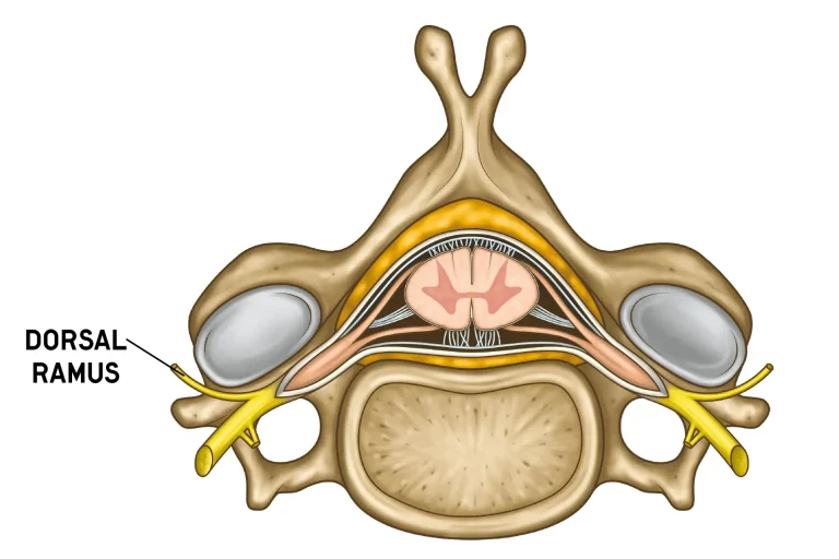 Cross-sectional diagram of vertebra highlighting the dorsal ramus.