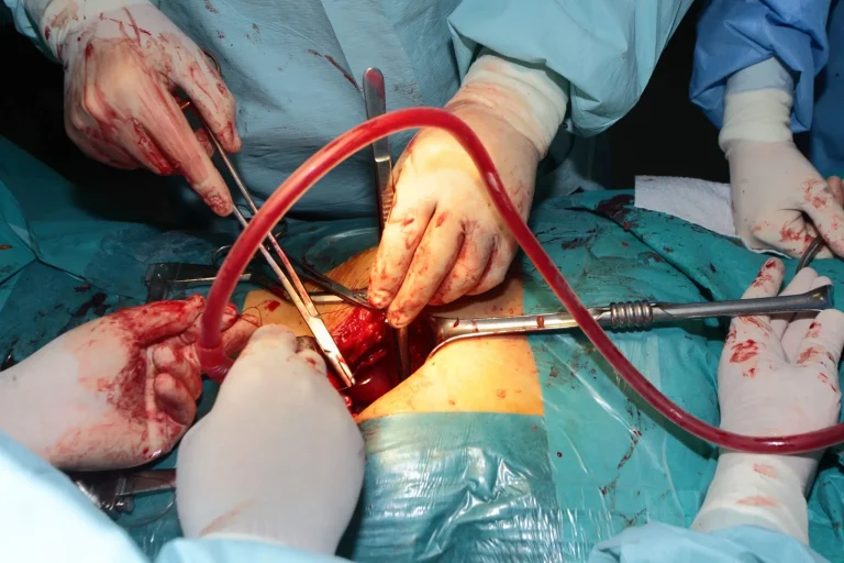 Surgeons operating with instruments and a red tube during a surgical procedure.