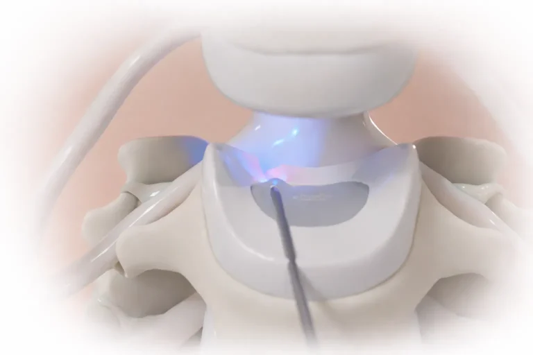 A medical device performing a procedure on a skeletal neck model.