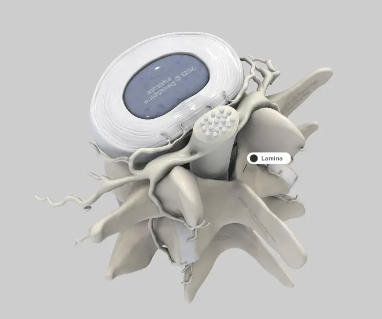 D model of a spinal vertebra with highlighted lamina and labeled nerves.