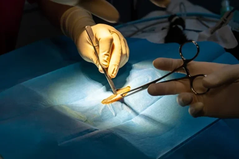Microdiscectomy Surgeons' hands performing a procedure under bright surgical lighting.