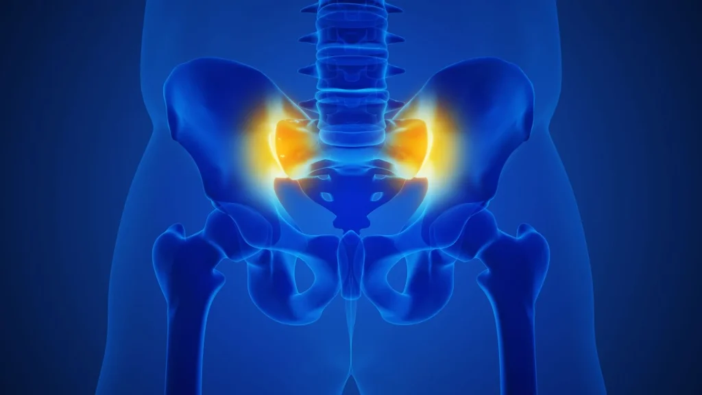 X-ray illustration of a human pelvic region with highlighted sacroiliac joints.
