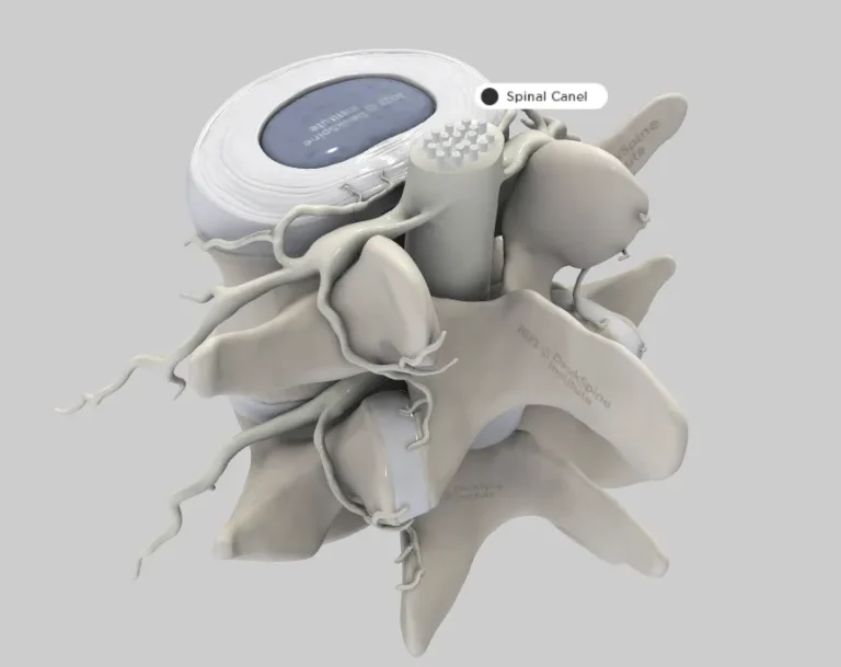 D model of a spinal structure with labeled spinal canal.