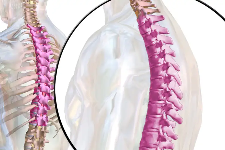 Illustration of a human spine with a close-up on the thoracic vertebrae highlighted in pink.