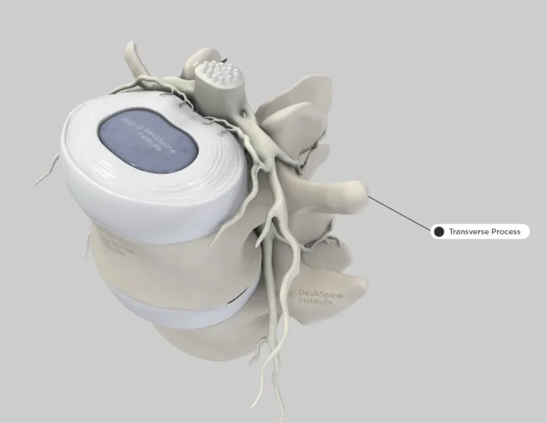 D spine model with labeled transverse process.