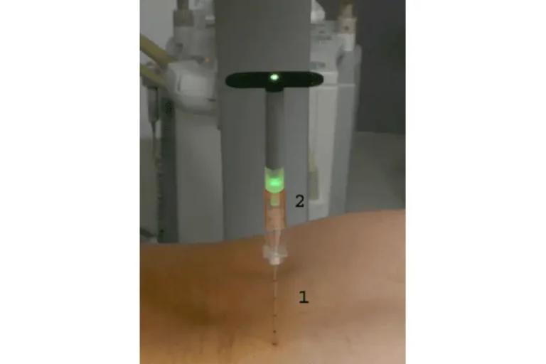 A needle with a glowing green indicator is inserted into a person's skin.
