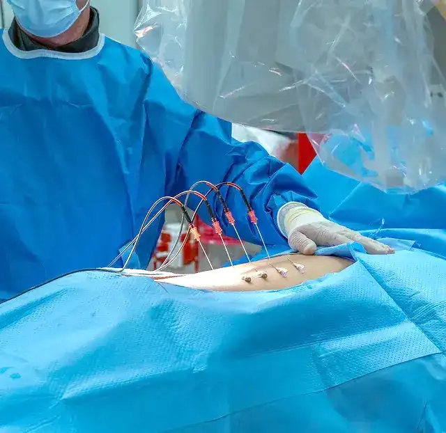 Surgeon in blue attire operating on a patient with medical wires on their abdomen.