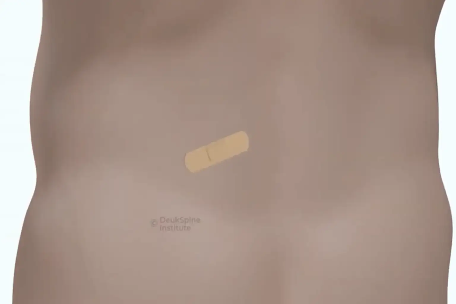 same day recovery A small bandage on a person's lower back.