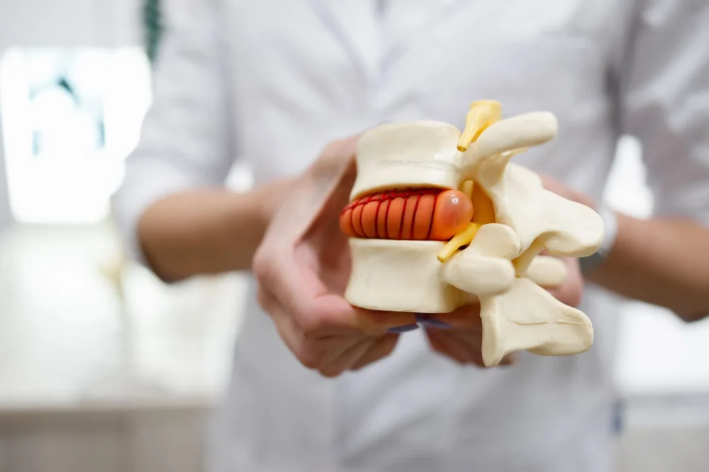 Person holding a model of a spinal vertebra with a protruding red disc.